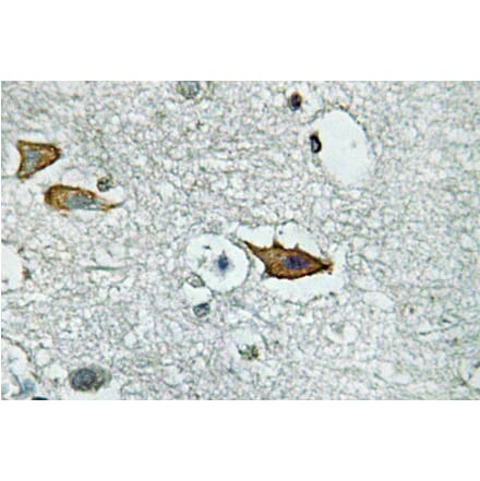 Immunohistochemistry - Anti-IL-5Ralpha Antibody (R12-2213) - Antibodies.com