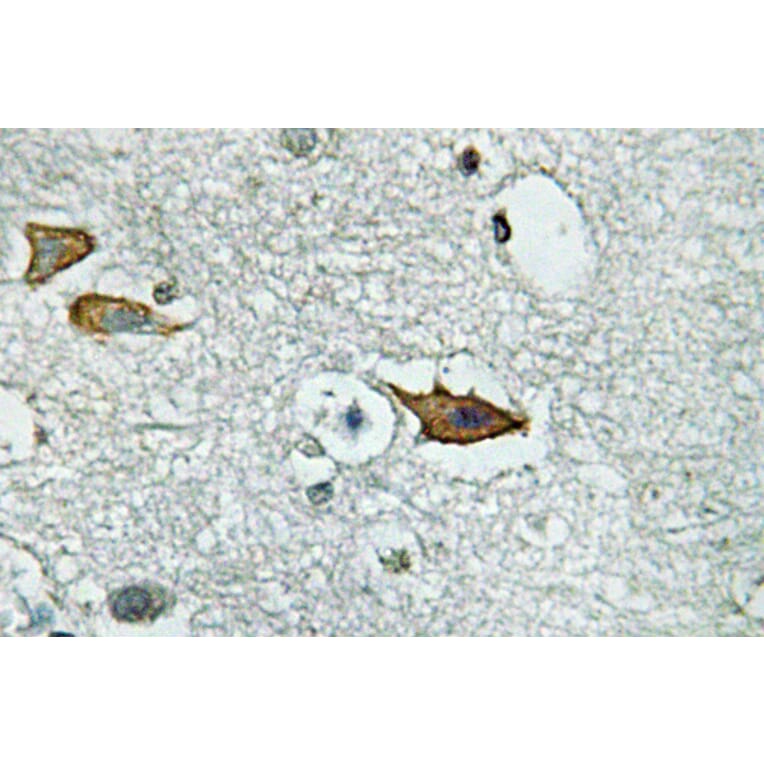 Immunohistochemistry - Anti-IL-5Ralpha Antibody (R12-2213) - Antibodies.com