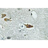 Immunohistochemistry - Anti-IL-5Ralpha Antibody (R12-2213) - Antibodies.com