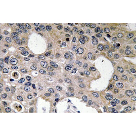 Immunohistochemistry - Anti-IL-4Ralpha Antibody (R12-2211) - Antibodies.com