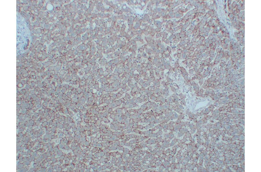 Immunohistochemistry - Anti-N Cadherin Antibody (V0102) - Antibodies.com