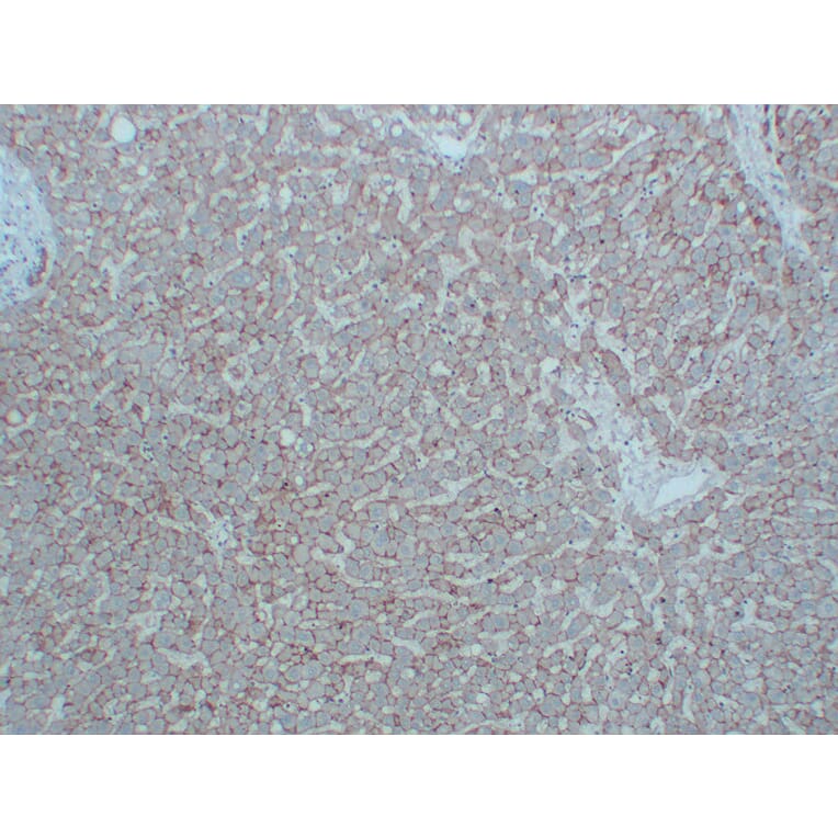 Immunohistochemistry - Anti-N Cadherin Antibody (V0102) - Antibodies.com