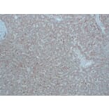 Immunohistochemistry - Anti-N Cadherin Antibody (V0102) - Antibodies.com