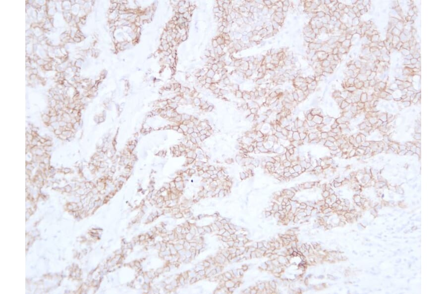 Immunohistochemistry - Anti-E Cadherin Antibody (V0066) - Antibodies.com