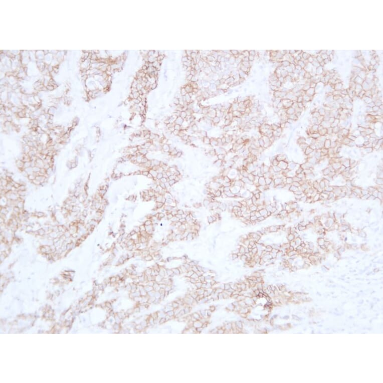 Immunohistochemistry - Anti-E Cadherin Antibody (V0066) - Antibodies.com