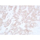 Immunohistochemistry - Anti-E Cadherin Antibody (V0066) - Antibodies.com