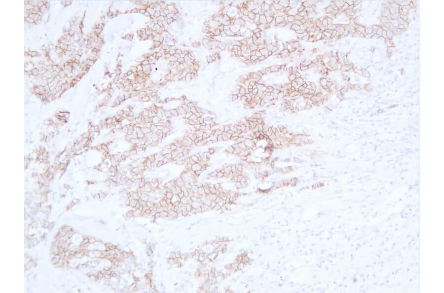 Immunohistochemistry - Anti-E Cadherin Antibody (V0066) - Antibodies.com