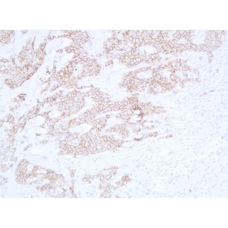 Immunohistochemistry - Anti-E Cadherin Antibody (V0066) - Antibodies.com