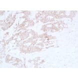 Immunohistochemistry - Anti-E Cadherin Antibody (V0066) - Antibodies.com