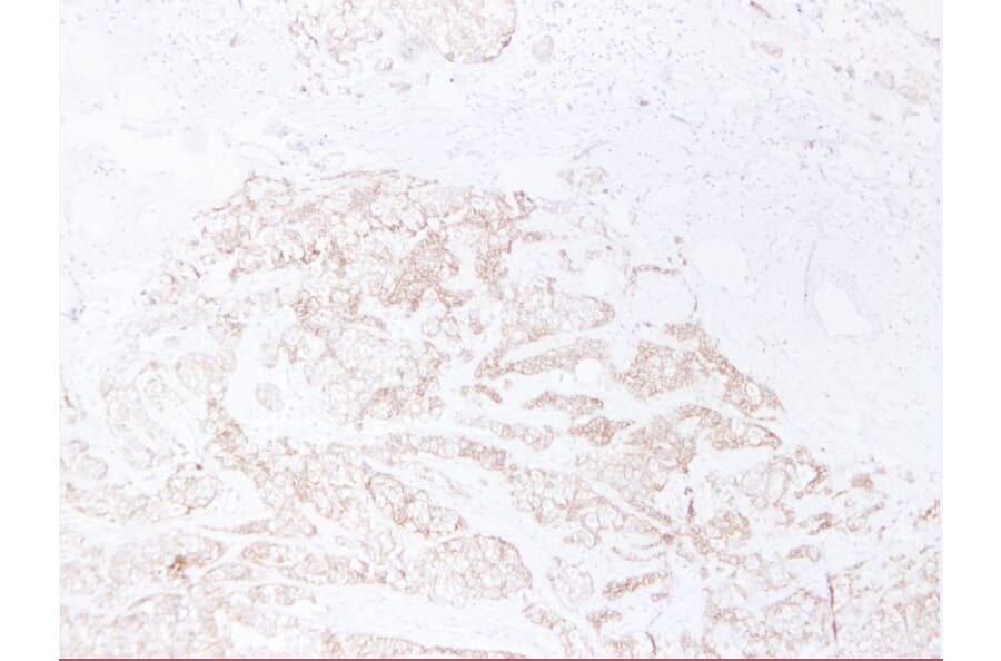 Immunohistochemistry - Anti-E Cadherin Antibody (V0066) - Antibodies.com