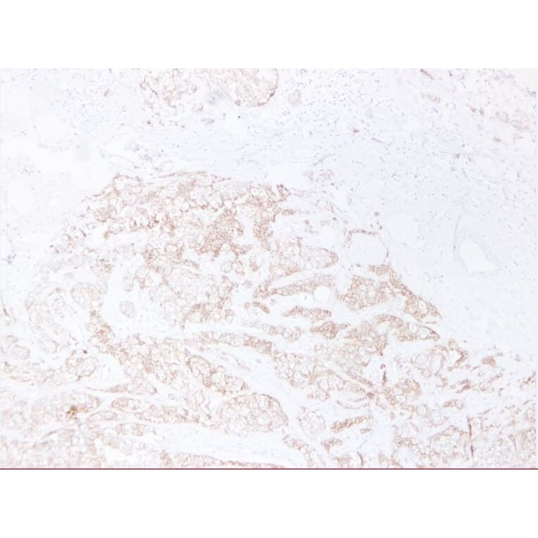 Immunohistochemistry - Anti-E Cadherin Antibody (V0066) - Antibodies.com