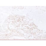 Immunohistochemistry - Anti-E Cadherin Antibody (V0066) - Antibodies.com