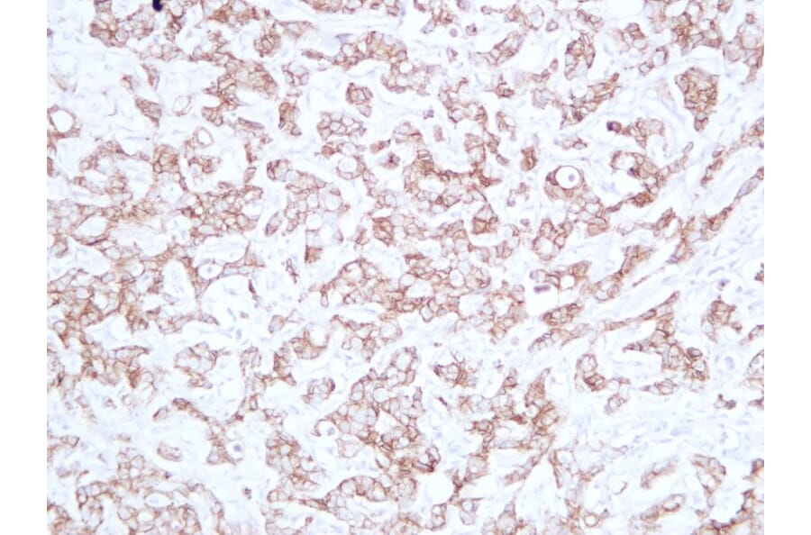 Immunohistochemistry - Anti-E Cadherin Antibody (V0066) - Antibodies.com