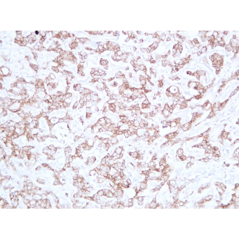 Immunohistochemistry - Anti-E Cadherin Antibody (V0066) - Antibodies.com