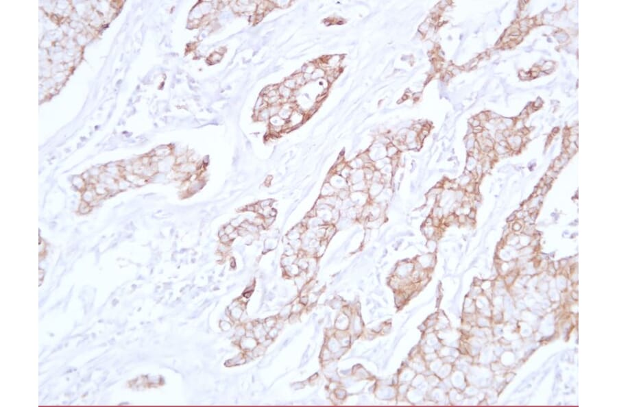 Immunohistochemistry - Anti-E Cadherin Antibody (V0066) - Antibodies.com