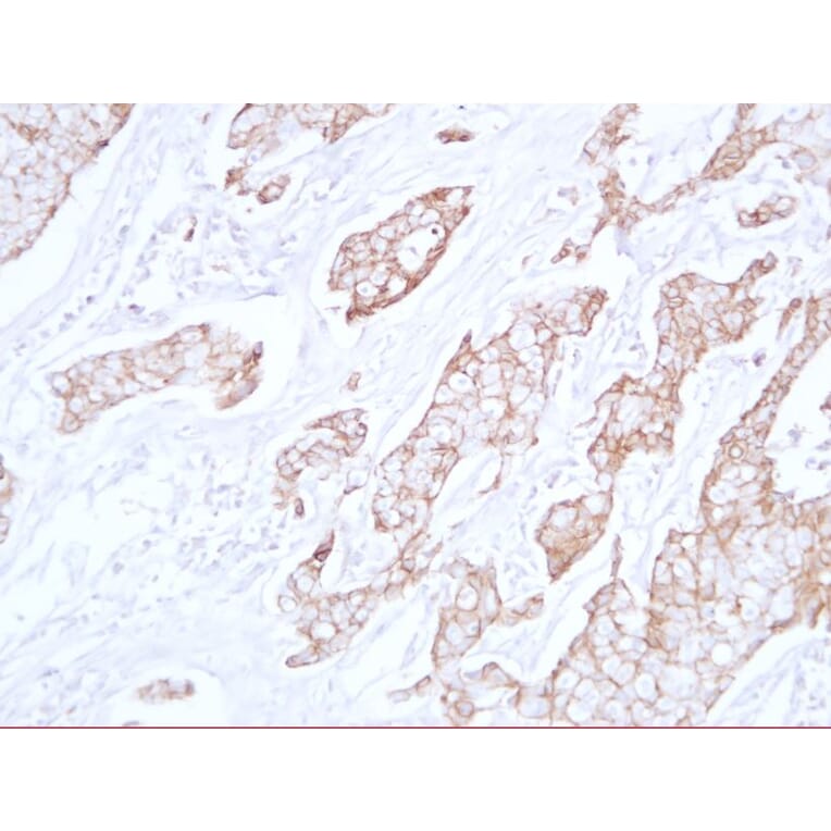 Immunohistochemistry - Anti-E Cadherin Antibody (V0066) - Antibodies.com