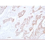 Immunohistochemistry - Anti-E Cadherin Antibody (V0066) - Antibodies.com