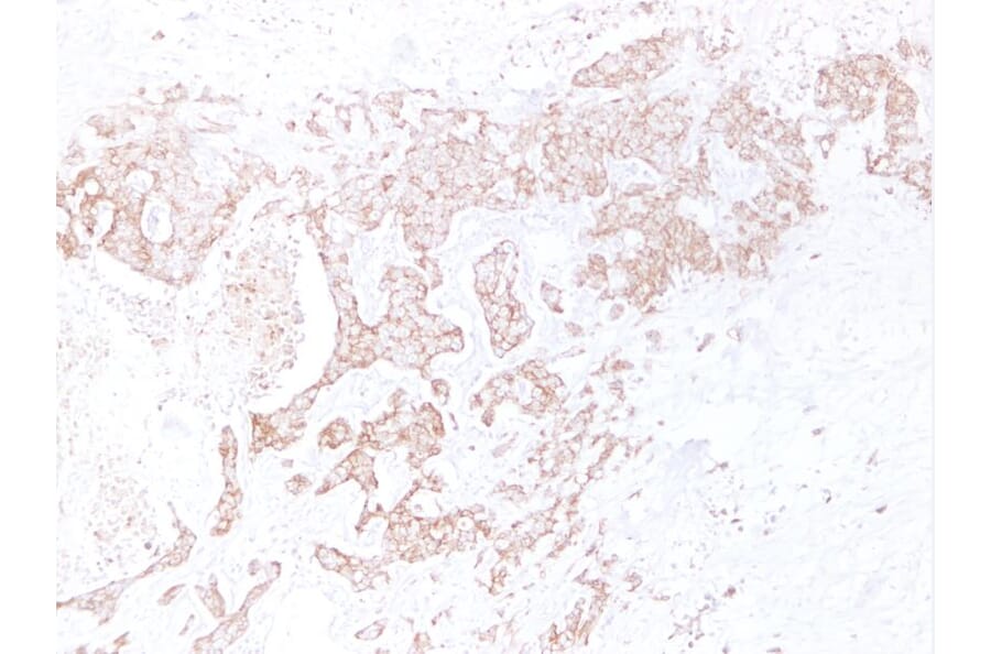 Immunohistochemistry - Anti-E Cadherin Antibody (V0066) - Antibodies.com