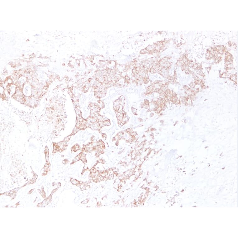 Immunohistochemistry - Anti-E Cadherin Antibody (V0066) - Antibodies.com