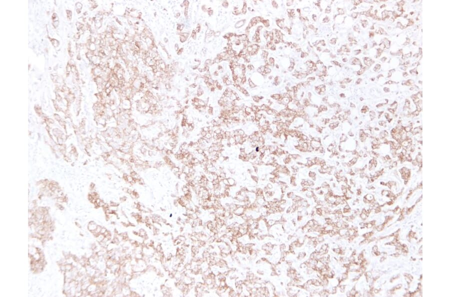 Immunohistochemistry - Anti-E Cadherin Antibody (V0066) - Antibodies.com