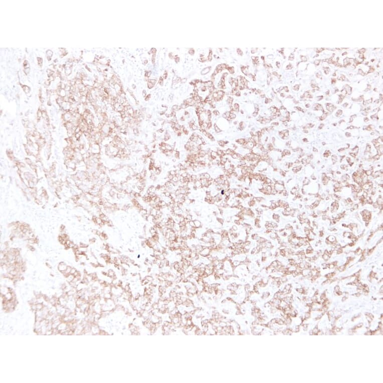 Immunohistochemistry - Anti-E Cadherin Antibody (V0066) - Antibodies.com