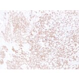 Immunohistochemistry - Anti-E Cadherin Antibody (V0066) - Antibodies.com