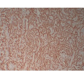 Immunohistochemistry - Anti-Calretinin Antibody (V0014) - Antibodies.com