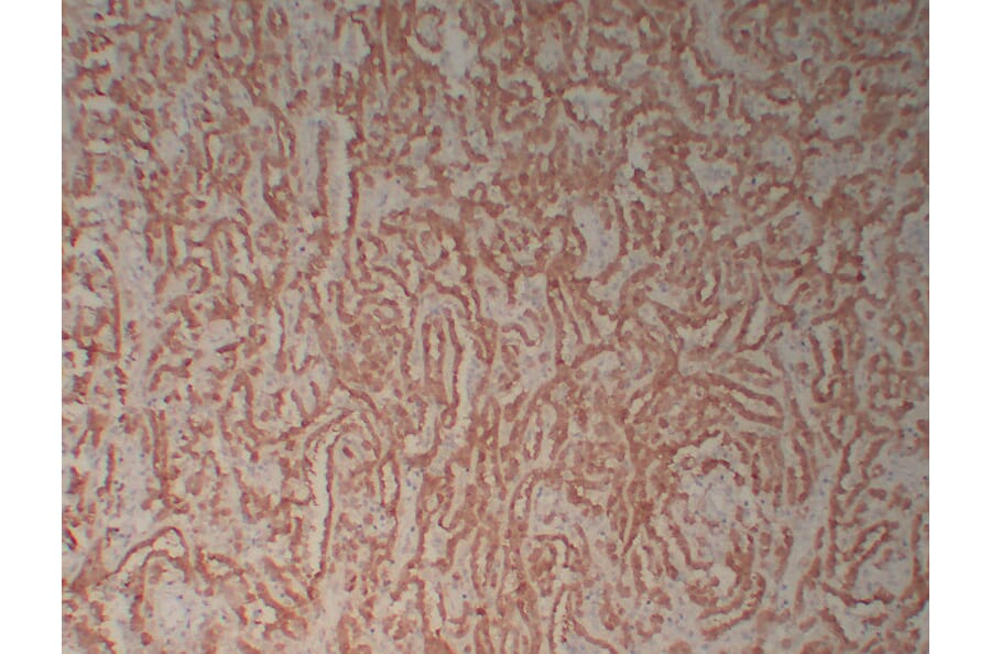 Immunohistochemistry - Anti-Calretinin Antibody (V0014) - Antibodies.com