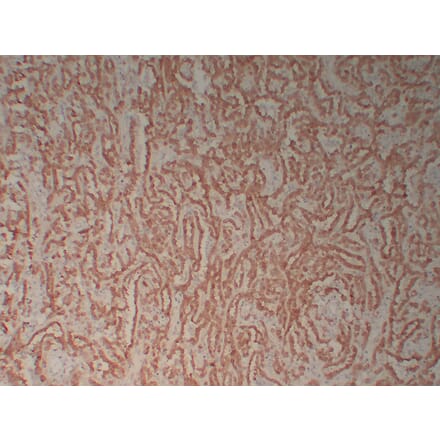Immunohistochemistry - Anti-Calretinin Antibody (V0014) - Antibodies.com
