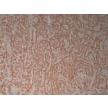 Immunohistochemistry - Anti-Calretinin Antibody (V0014) - Antibodies.com
