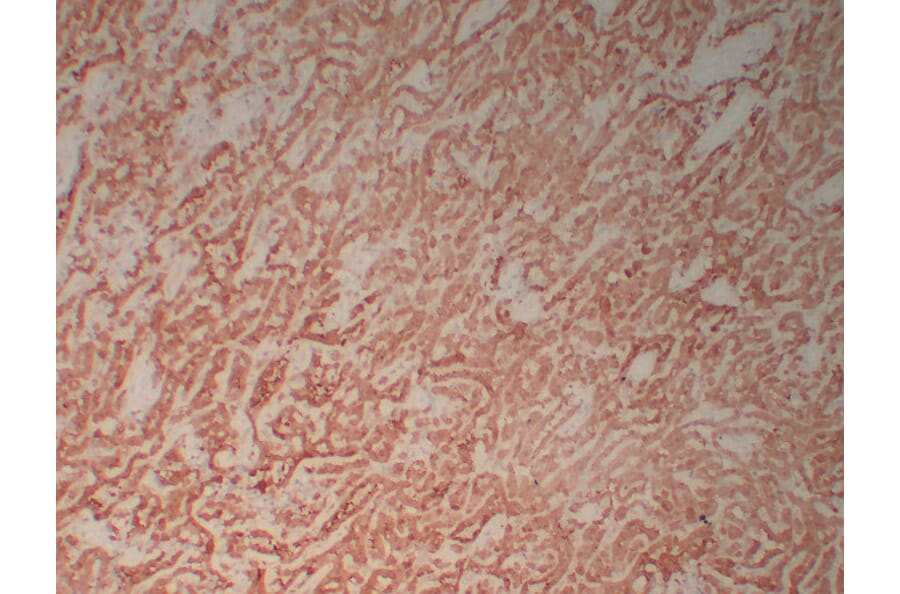 Immunohistochemistry - Anti-Calretinin Antibody (V0014) - Antibodies.com