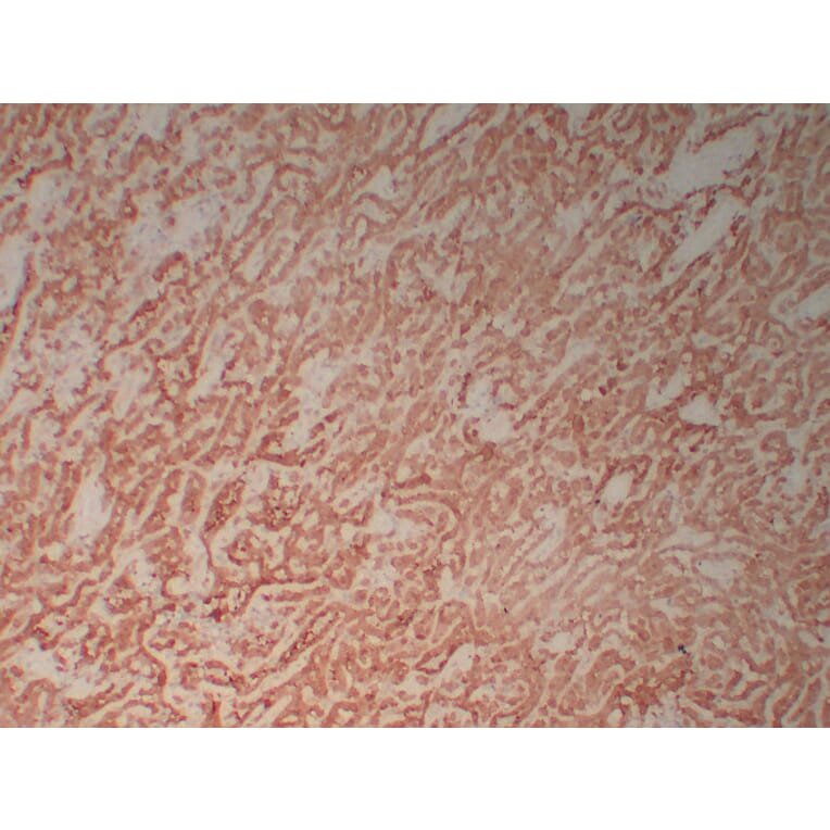Immunohistochemistry - Anti-Calretinin Antibody (V0014) - Antibodies.com