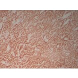 Immunohistochemistry - Anti-Calretinin Antibody (V0014) - Antibodies.com