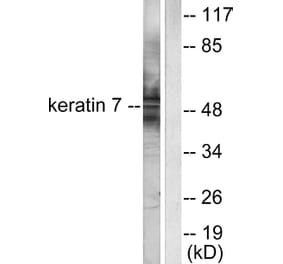 Western Blot - Anti-Keratin 7 Antibody (C0247) - Antibodies.com