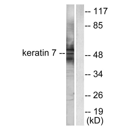 Western Blot - Anti-Keratin 7 Antibody (C0247) - Antibodies.com