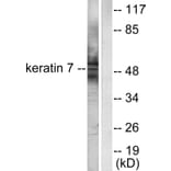 Western Blot - Anti-Keratin 7 Antibody (C0247) - Antibodies.com