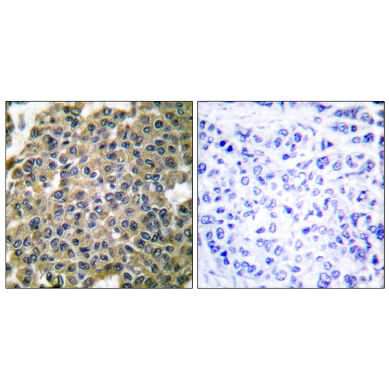 Immunohistochemistry - Anti-Keratin 7 Antibody (C0247) - Antibodies.com