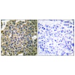 Immunohistochemistry - Anti-Keratin 7 Antibody (C0247) - Antibodies.com