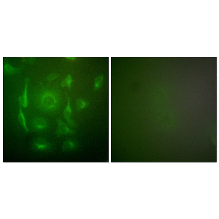 Immunofluorescence - Anti-Keratin 7 Antibody (C0247) - Antibodies.com