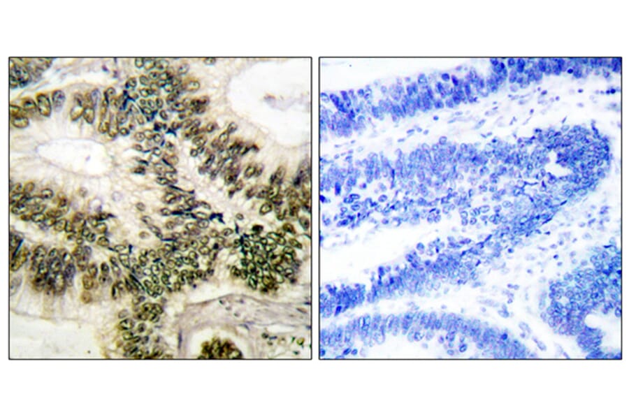 Immunohistochemistry - Anti-Cyclin E1 Antibody (B0069) - Antibodies.com