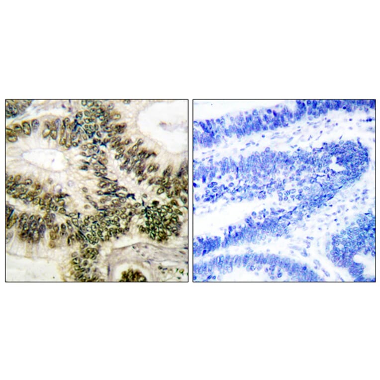 Immunohistochemistry - Anti-Cyclin E1 Antibody (B0069) - Antibodies.com
