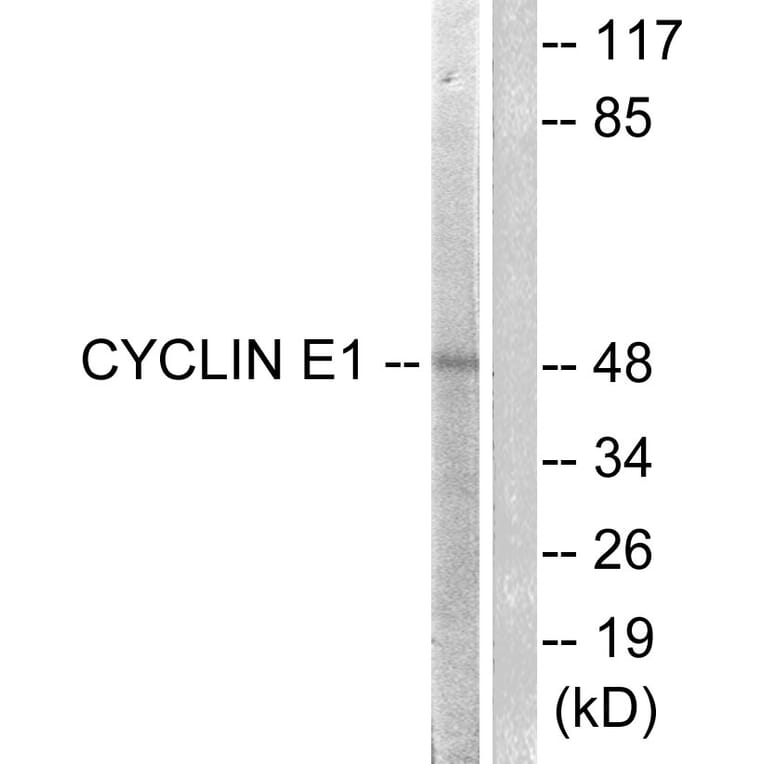 Western Blot - Anti-Cyclin E1 Antibody (B0069) - Antibodies.com