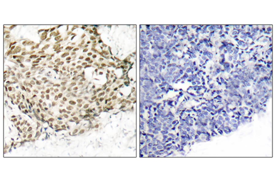 Immunohistochemistry - Anti-p95/NBS1 Antibody (B7160) - Antibodies.com