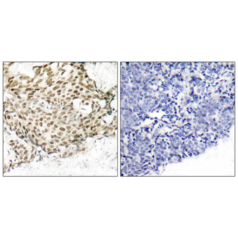 Immunohistochemistry - Anti-p95/NBS1 Antibody (B7160) - Antibodies.com