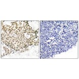 Immunohistochemistry - Anti-p95/NBS1 Antibody (B7160) - Antibodies.com