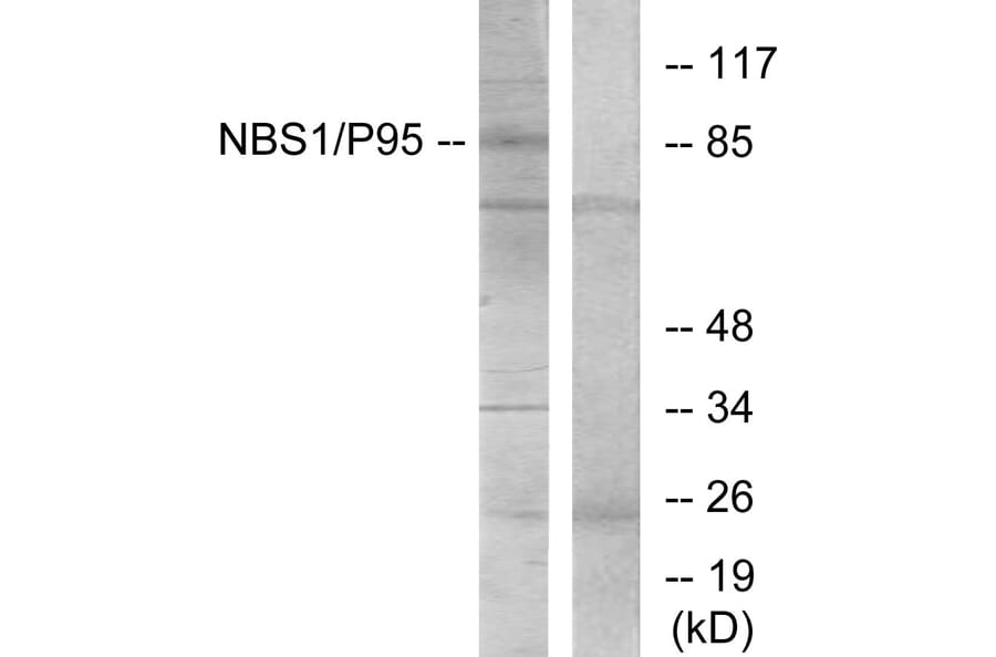 Western Blot - Anti-p95/NBS1 Antibody (B7160) - Antibodies.com