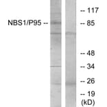 Western Blot - Anti-p95/NBS1 Antibody (B7160) - Antibodies.com