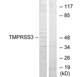 Western Blot - Anti-TMPRSS3 Antibody (C10761) - Antibodies.com