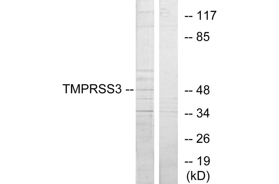Western Blot - Anti-TMPRSS3 Antibody (C10761) - Antibodies.com