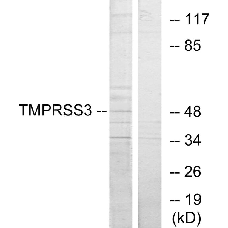 Western Blot - Anti-TMPRSS3 Antibody (C10761) - Antibodies.com